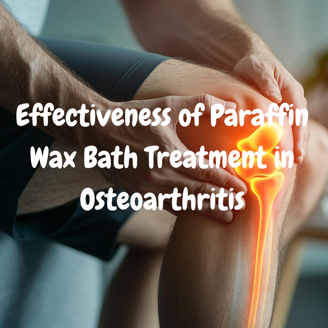 Effectiveness of Paraffin Wax Bath Treatment in Osteoarthritis